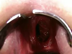 Trhání na kusy porno lékař kočička zralý pacientky
